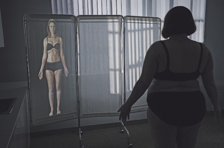 04_12_PV_Dietland_10_ 2018 AMC Networks Inc „Alicia „Plum“ Kettle imaginiert ihren postoperativen Körper in der Serie Dietland. Pressefoto Amazon